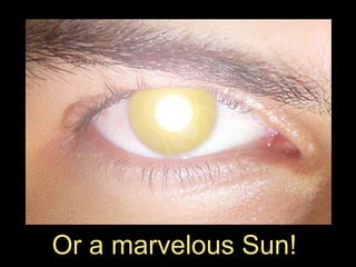 Or a marvelous Sun!  