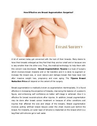 How Effective are Breast Augmentation Surgeries?
A lot of women today get concerned with the look of their breasts. Many desire to
have their breasts enlarged as they feel that they are too small and or because one
is way smaller than the other one. Thus, the medical technology to help them with
this concern was developed. Breast Augmentation Tijuana is a type of surgery
which involves breast implants and or fat transfers and it is done to augment or
increase the breast size, or even restore and reshape breast that have been lost
after massive weight loss, pregnancy and even aging. The Tijuana Breast
Reduction Price will depend on the extent of the surgery.
Breast augmentation is medically known as augmentation mammoplasty. It is found
effective in increasing the projection of breasts, improving the balance of a person’s
figure, and enhancing self confidence as better self-image is achieved. Also it is
effective for breast reconstructions after injuries. In addition, breast augmentation
may be done after breast cancer treatment or because of other conditions and
injuries that affected the size and shape of the breasts. Breast augmentation
involves putting artificial breast tissues under the chest muscle just behind the
breast. For implants, an outer layer of silicone is implanted on the breast which is a
bag filled with silicone gel or salt water.
 