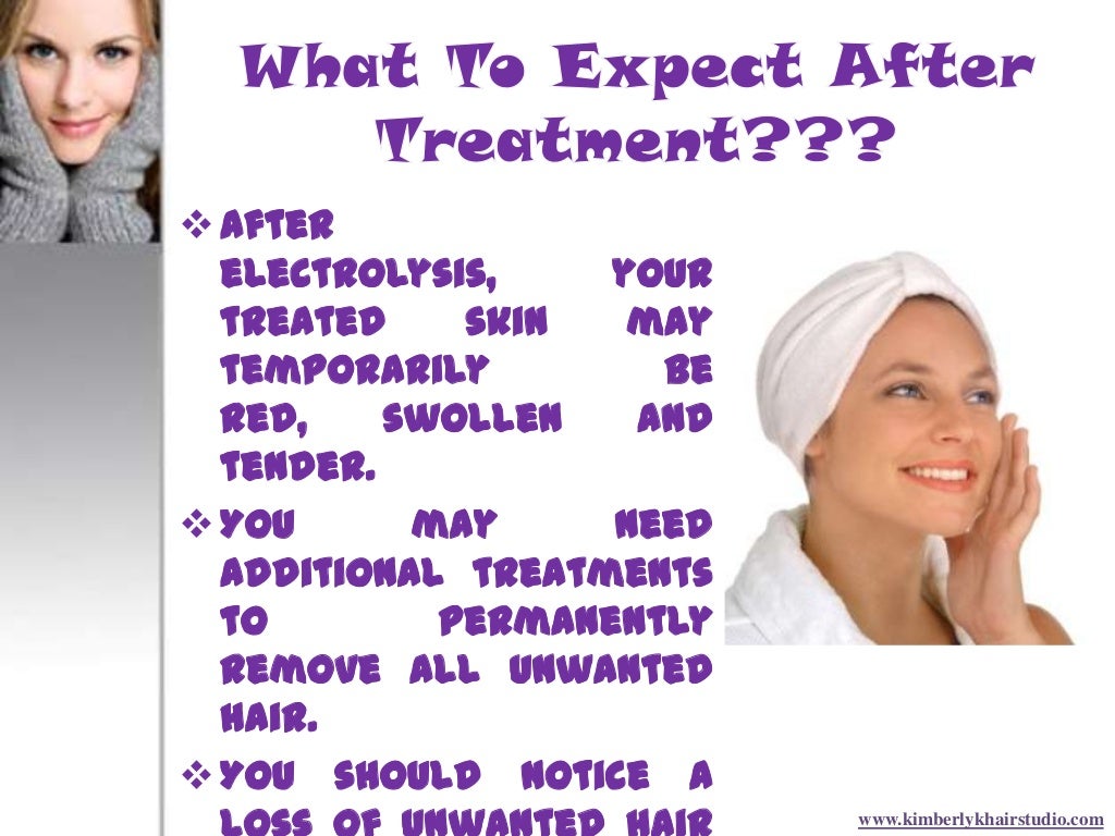 How electrolysis hair removal technique works