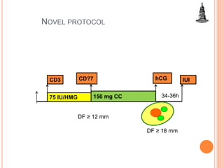 NOVEL PROTOCOL
75 IU/HMG
CD3 CD?7
150 mg CC
hCG IUI
DF ≥ 18 mm
34-36h
DF ≥ 12 mm
 