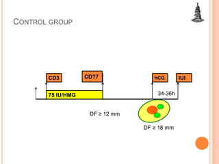CONTROL GROUP
75 IU/HMG
CD3 hCG IUI
DF ≥ 18 mm
CD7
34-36h
DF ≥ 12 mm
CD?7
 
