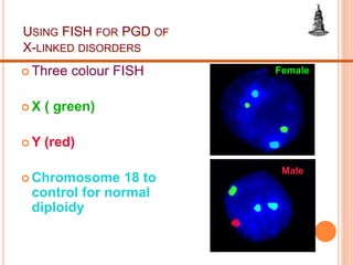 USING FISH FOR PGD OF
X-LINKED DISORDERS
 Three colour FISH
 X ( green)
 Y (red)
 Chromosome 18 to
control for normal
diploidy
Male
Female
 