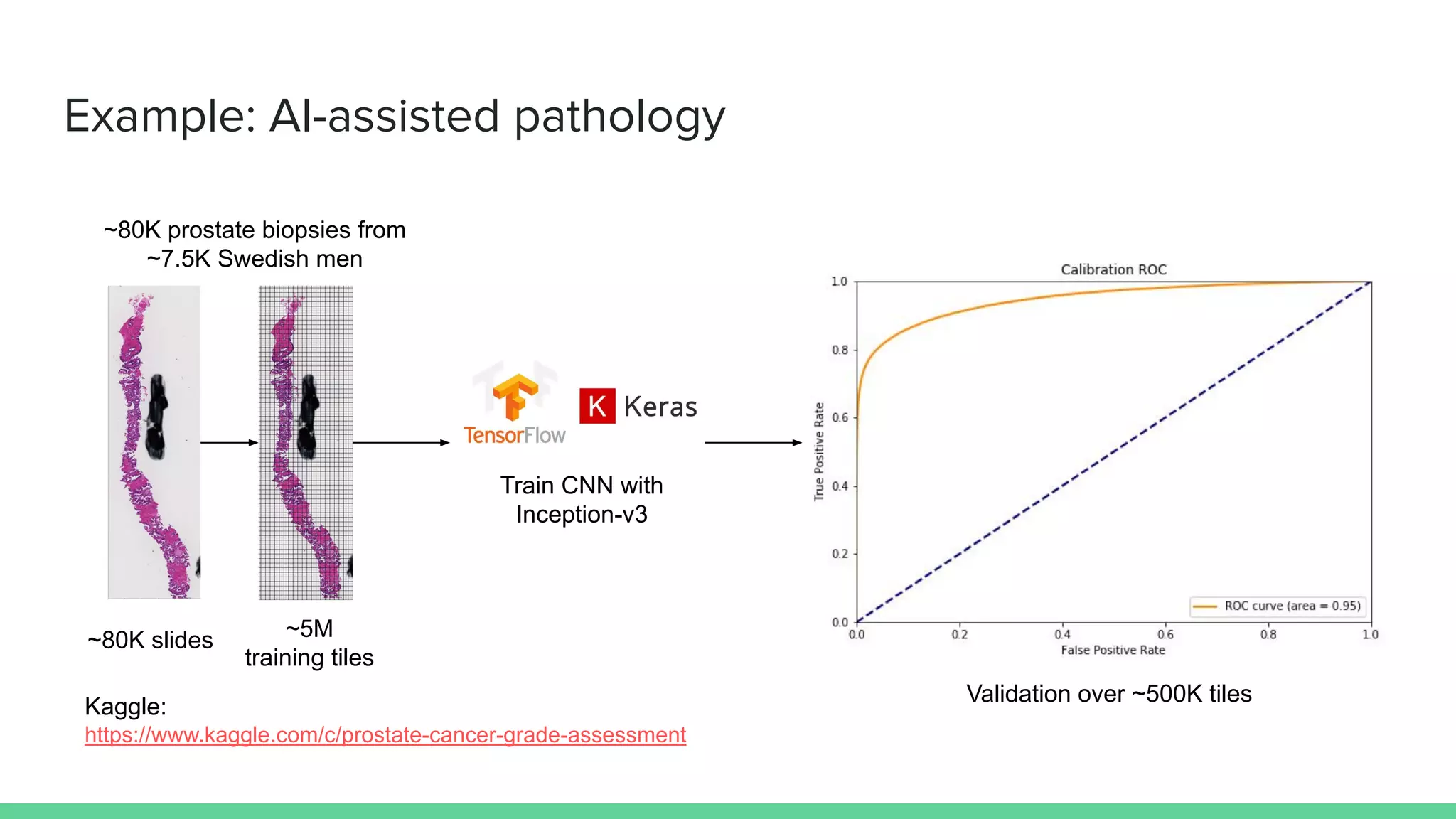 Example: AI-assisted pathology
~80K prostate biopsies from
~7.5K Swedish men
~80K slides ~5M
training tiles
Train CNN with
Inception-v3
Validation over ~500K tiles
Kaggle:
https://www.kaggle.com/c/prostate-cancer-grade-assessment
 