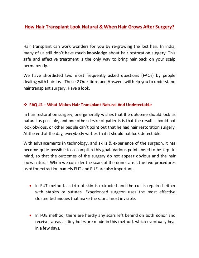 How Hair Transplant Look Natural After Hair Transplant