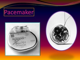 Pacemaker
 