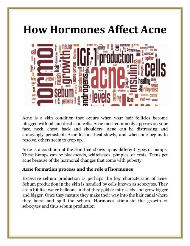 How hormones affect acne