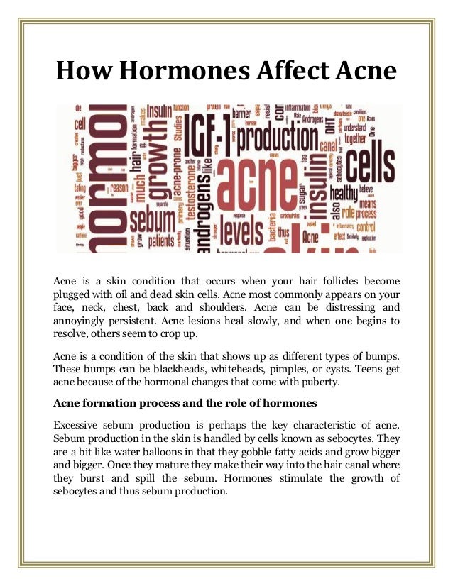 How Hormones Affect Acne