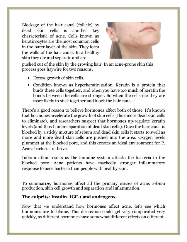 How hormones affect acne