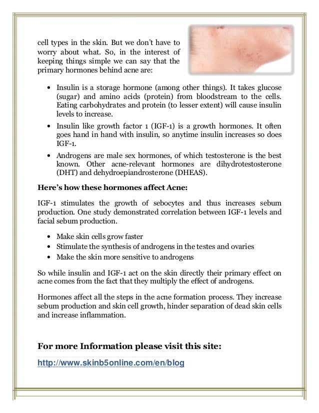 How hormones affect acne