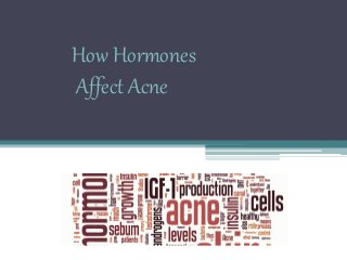 How Hormones 
Affect Acne 
 
