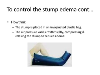 To control the stump edema cont…
• Flowtron:
– The stump is placed in an invaginated plastic bag.
– The air pressure varies rhythmically, compressing &
relaxing the stump to reduce edema.
 