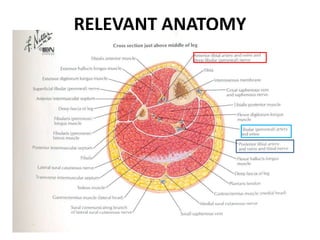 RELEVANT ANATOMY
 
