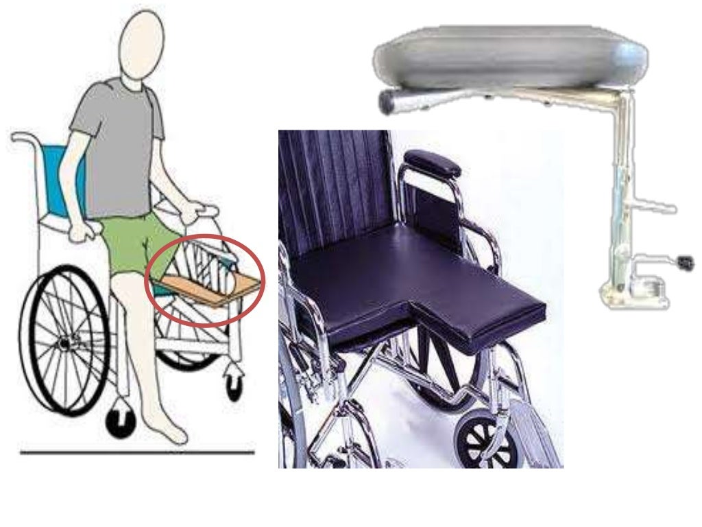 How i do below knee amputation