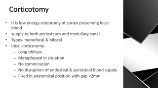 How I do Ilizarov Tibia.pptx