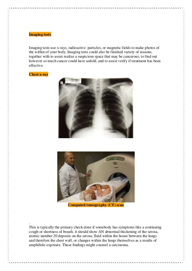 chest x ray copd vs normal