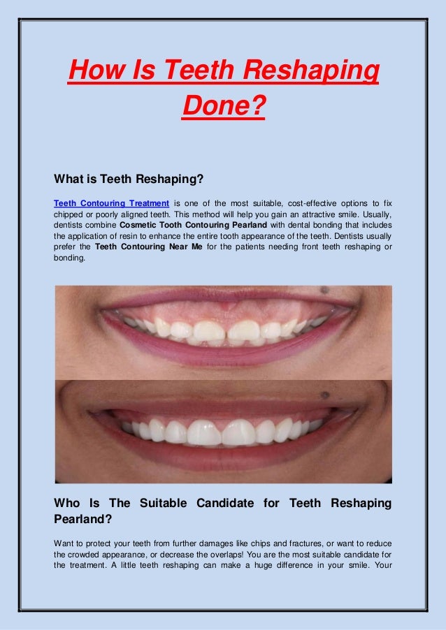 How is teeth reshaping done