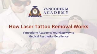 How Laser Tattoo Removal Works
Vancoderm Academy: Your Gateway to
Medical Aesthetics Excellence
 