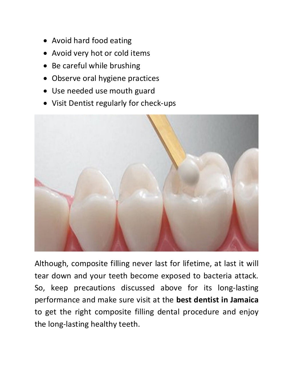 How Long Composite Fillings Last and Take Care of It?