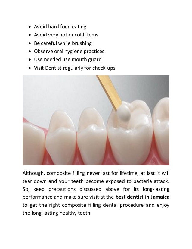 How Long Composite Fillings Last and Take Care of It?