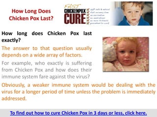 How Long Does
   Chicken Pox Last?

How long does Chicken Pox last
exactly?
The answer to that question usually
depends on a wide array of factors.
For example, who exactly is suffering
from Chicken Pox and how does their
immune system fare against the virus?
Obviously, a weaker immune system would be dealing with the
virus for a longer period of time unless the problem is immediately
addressed.

   To find out how to cure Chicken Pox in 3 days or less, click here.
 