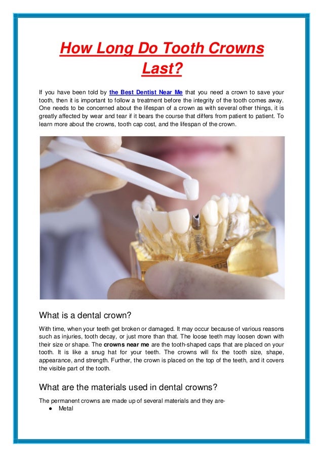 How Long Do Tooth Crowns Last.pdf