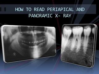 HOW TO READ PERIAPICAL AND
     PANORAMIC X- RAY
 