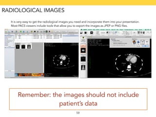 It is very easy to get the radiological images you need and incorporate them into your presentation. 
Most PACS viewers in...
