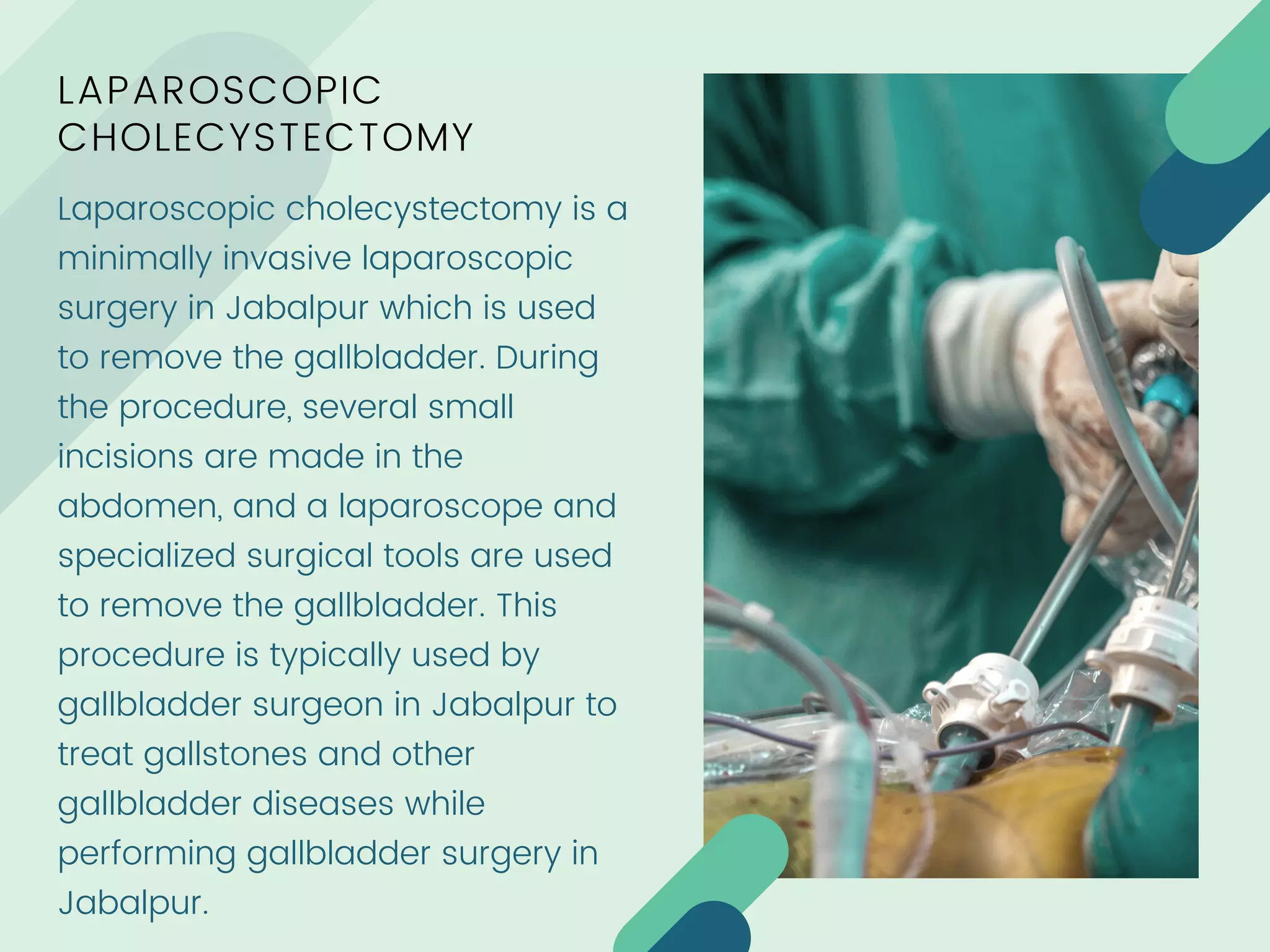how-many-types-of-laparoscopic-surgery-are-there-ppt