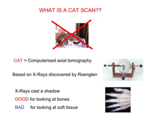 WHAT IS A CAT SCAN??
CAT = Computerised axial tomography
Based on X-Rays discovered by Roengten
X-Rays cast a shadow
GOOD for looking at bones
BAD for looking at soft tissue
 