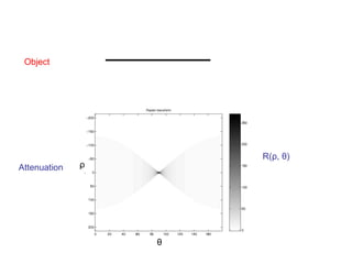 Object
Attenuation
R(ρ, θ)
θ
ρ
 