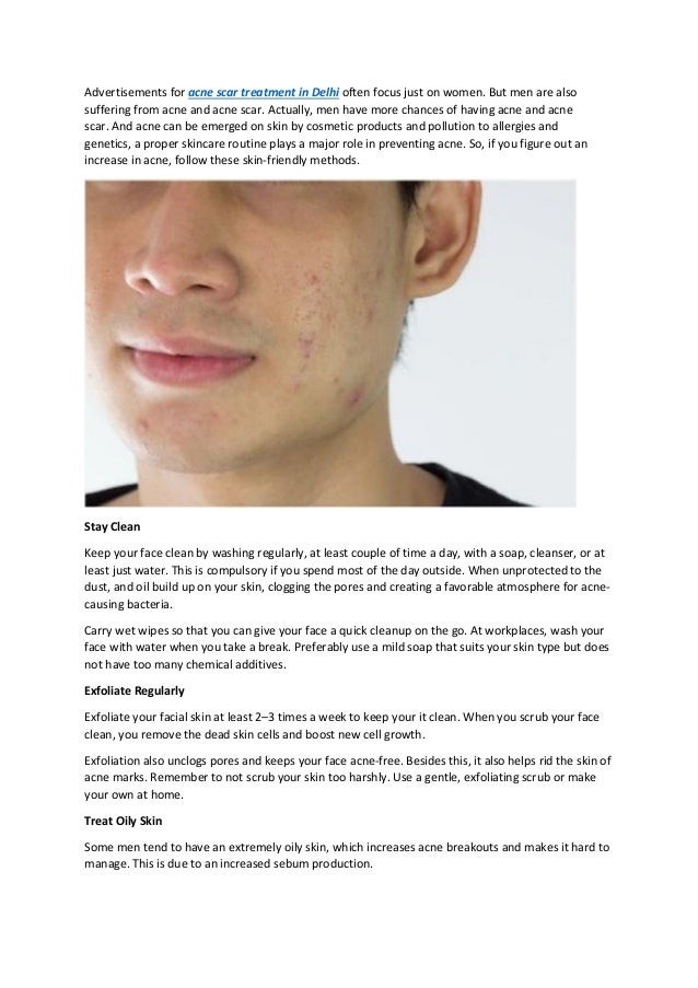 acne tips for guys
