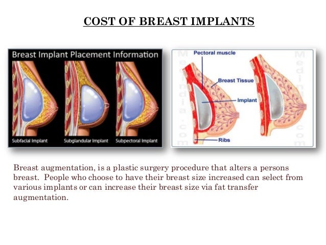 Boob Implants Cost 36
