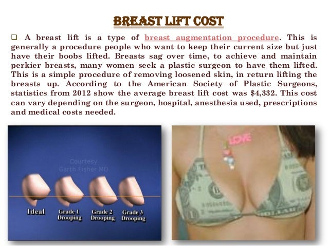 Boob Implants Cost 111