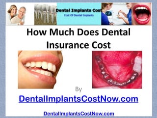 How Much Does Dental
    Insurance Cost



                By
DentalImplantsCostNow.com
     DentalImplantsCostNow.com
 