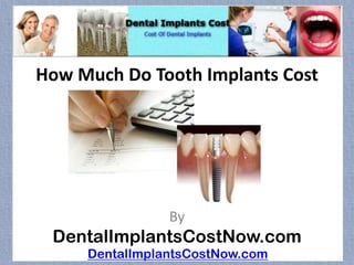 How Much Do Tooth Implants Cost




                By
 DentalImplantsCostNow.com
     DentalImplantsCostNow.com
 