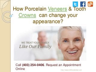 How Porcelain Veneers & Tooth
Crowns can change your
appearance?
Call (403) 254-0406. Request an Appointment
Online http://www.millrisedental.com
 
