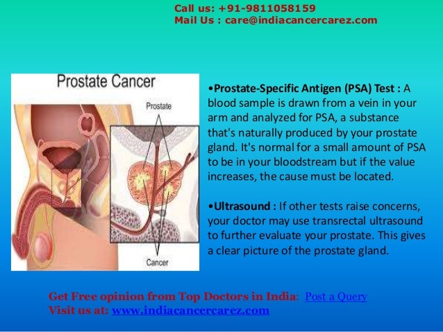 How prostate cancer is diagnosed Most Advanced