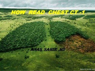 HOW READ CHEST CT -1




     ANAS SAHLE ,MD
 