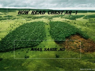 HOW READ CHEST XR -1




    ANAS SAHLE ,MD
 