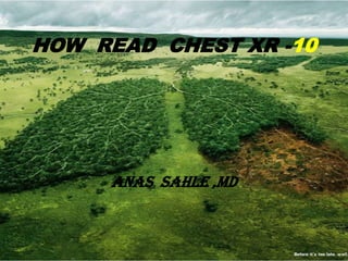 HOW READ CHEST XR -10




     ANAS SAHLE ,MD
 