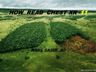 HOW READ CHEST XR -11




     ANAS SAHLE ,MD
 