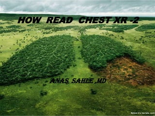 HOW READ CHEST XR -2




     ANAS SAHLE ,MD
 
