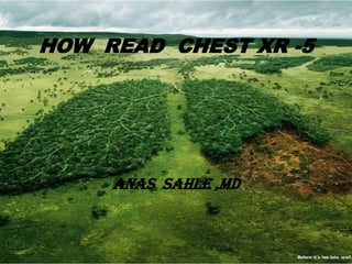 HOW READ CHEST XR -5




     ANAS SAHLE ,MD
 
