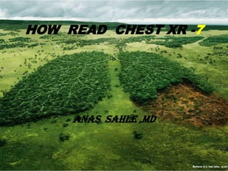HOW READ CHEST XR -7




     ANAS SAHLE ,MD
 