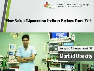 How Safe is Liposuction India to Reduce Extra Fat?
 