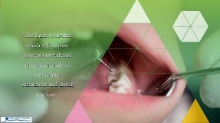 This leads to cavities
which will require
more invasive dental
procedures such as
root canals,
extractions and dental
implants.
 