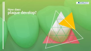 How does
plaque develop?
 