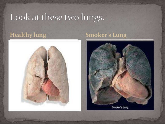 How smoking will affect your health