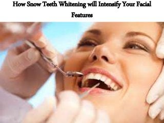 How Snow Teeth Whitening will Intensify Your Facial
Features
 