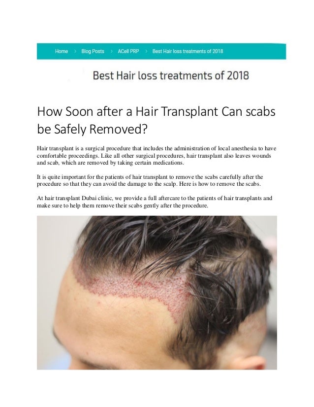 Made By Counterpoint Magazine Scab Hair